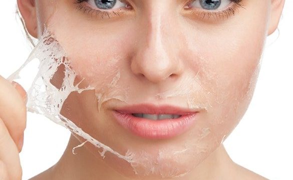 لایه برداری و جوان سازی پوست
